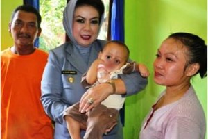 Dengan penuh kasih sayang, Bupati Kuningan menggendong anak penderita kelainan struktur.